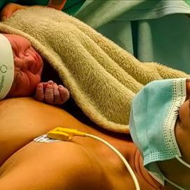 Hospiten fortalece el vínculo maternofetal ampliando el procedimiento piel con piel en cesáreas