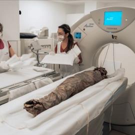 Hospiten participates in pioneering research on Guanche mummies