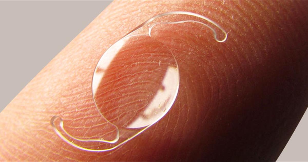 Detector línea pulgada Qué es una lente intraocular tórica?