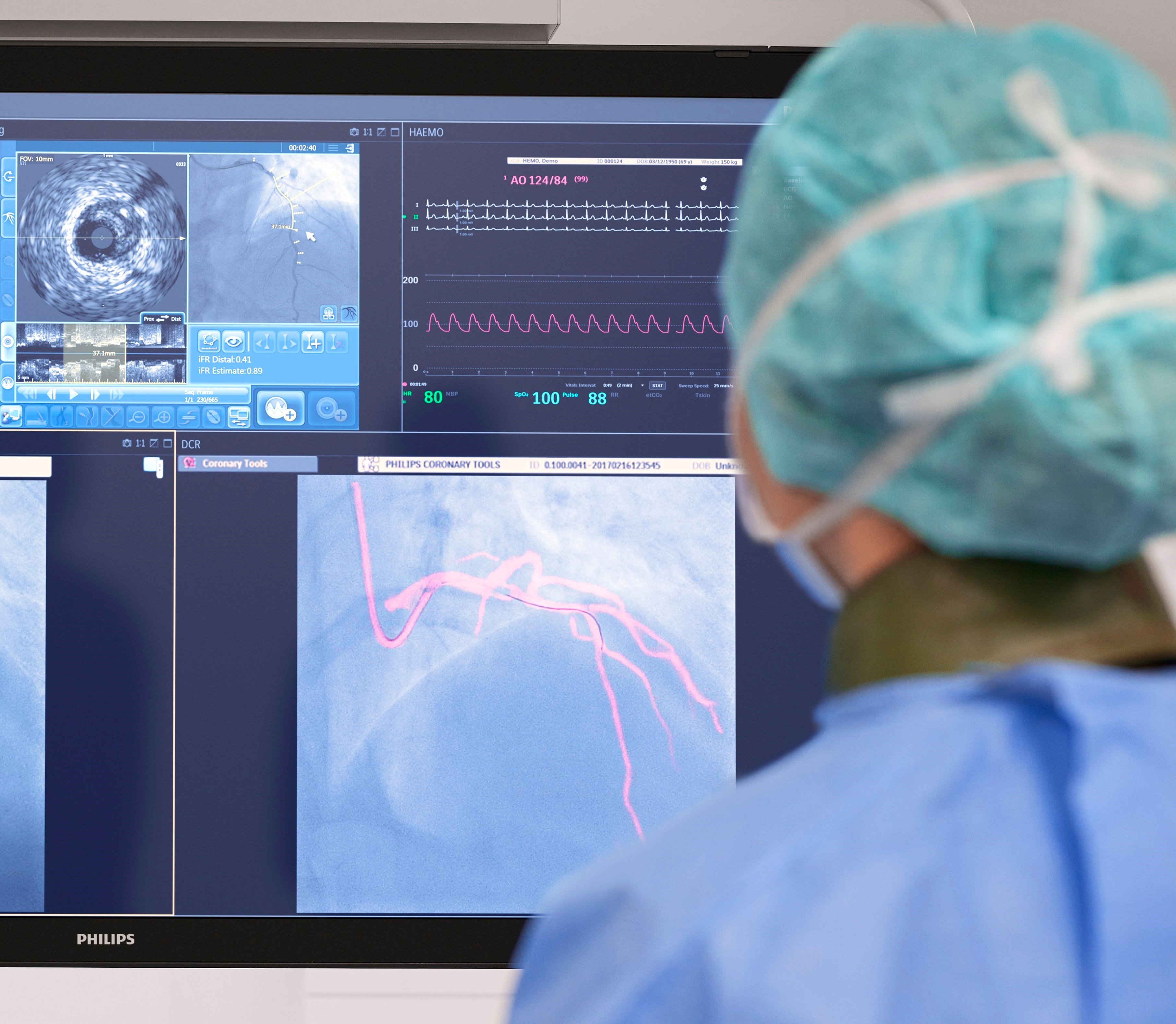 Interventional Cardiology