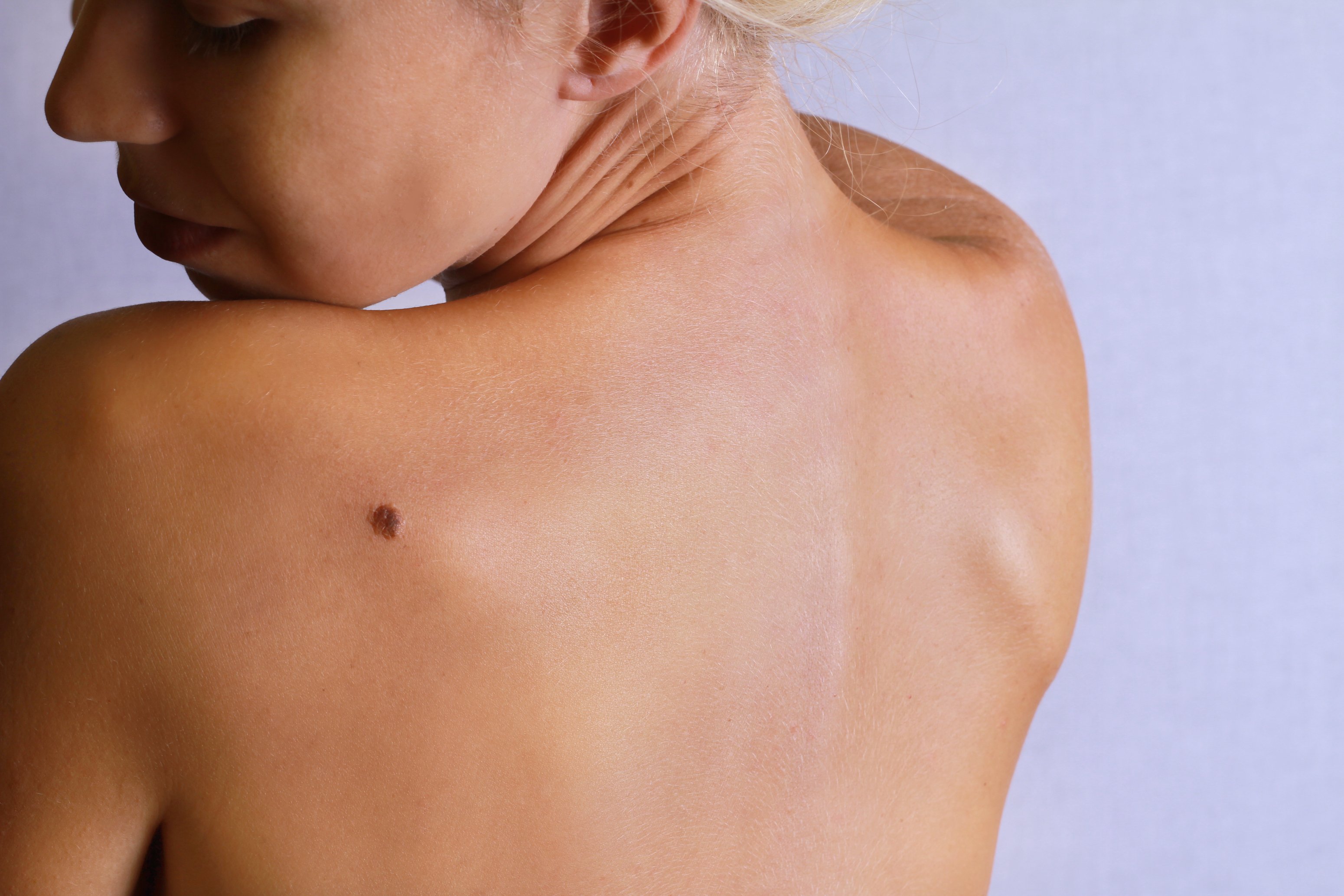 Dermatology and Venereology