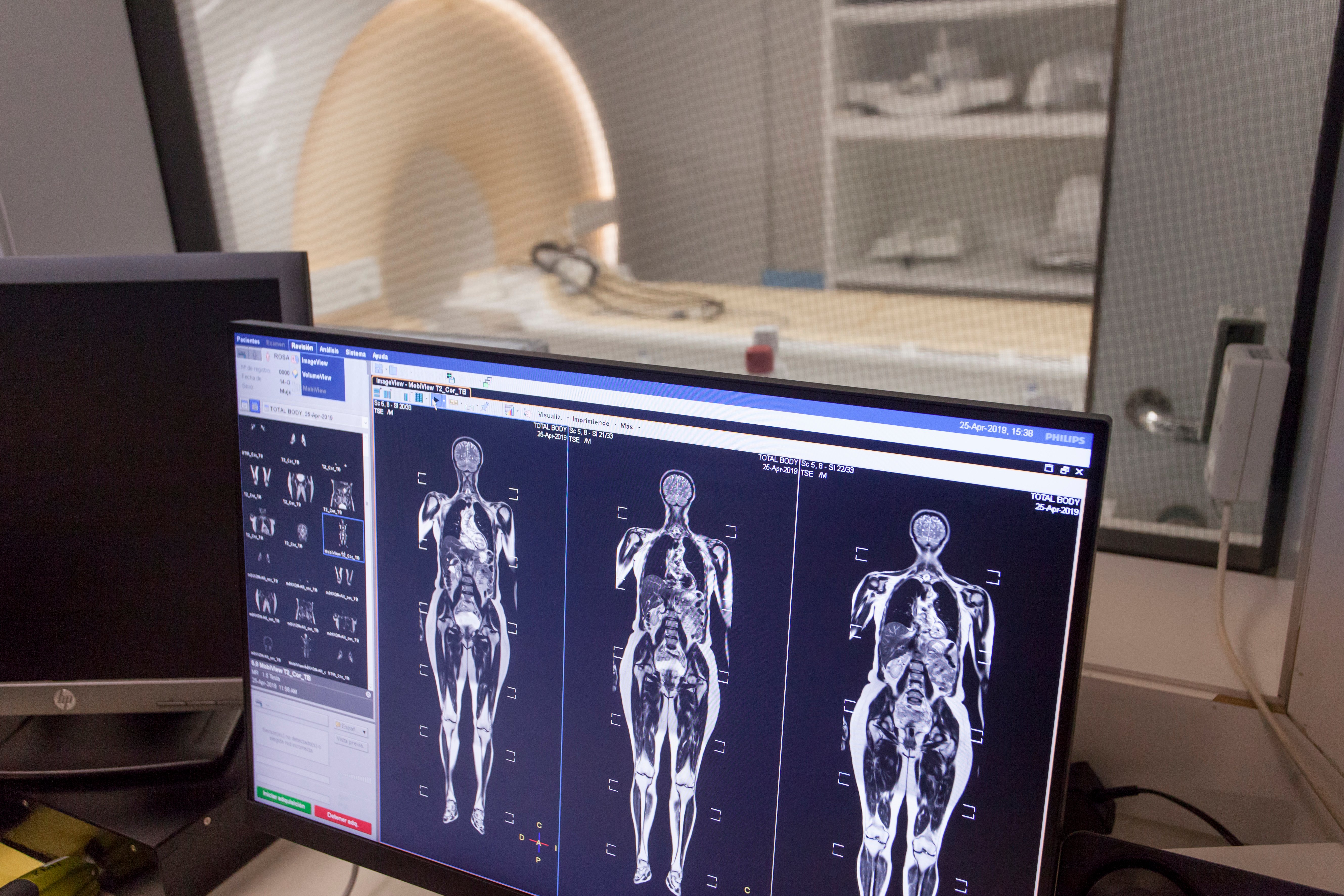 Neuroradiology