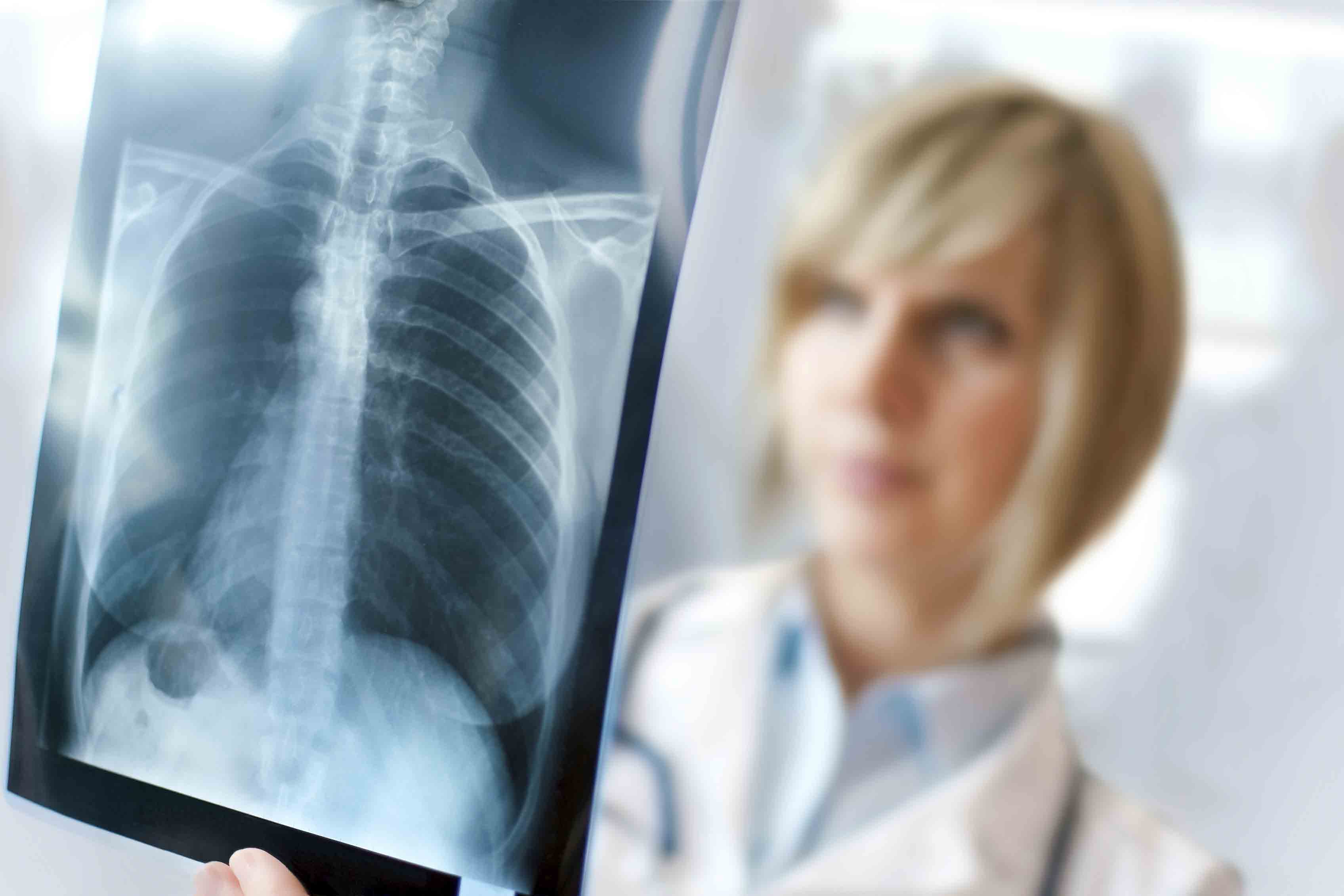 Radiology and Diagnostic Imaging