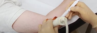 Find out what you have and how to treat it in a single consultation with ultrasound-guided infiltrations