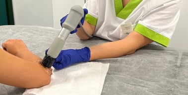 El tratamiento con ondas de choque permite mejorar la calidad de vida de los pacientes