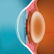 icl ojo