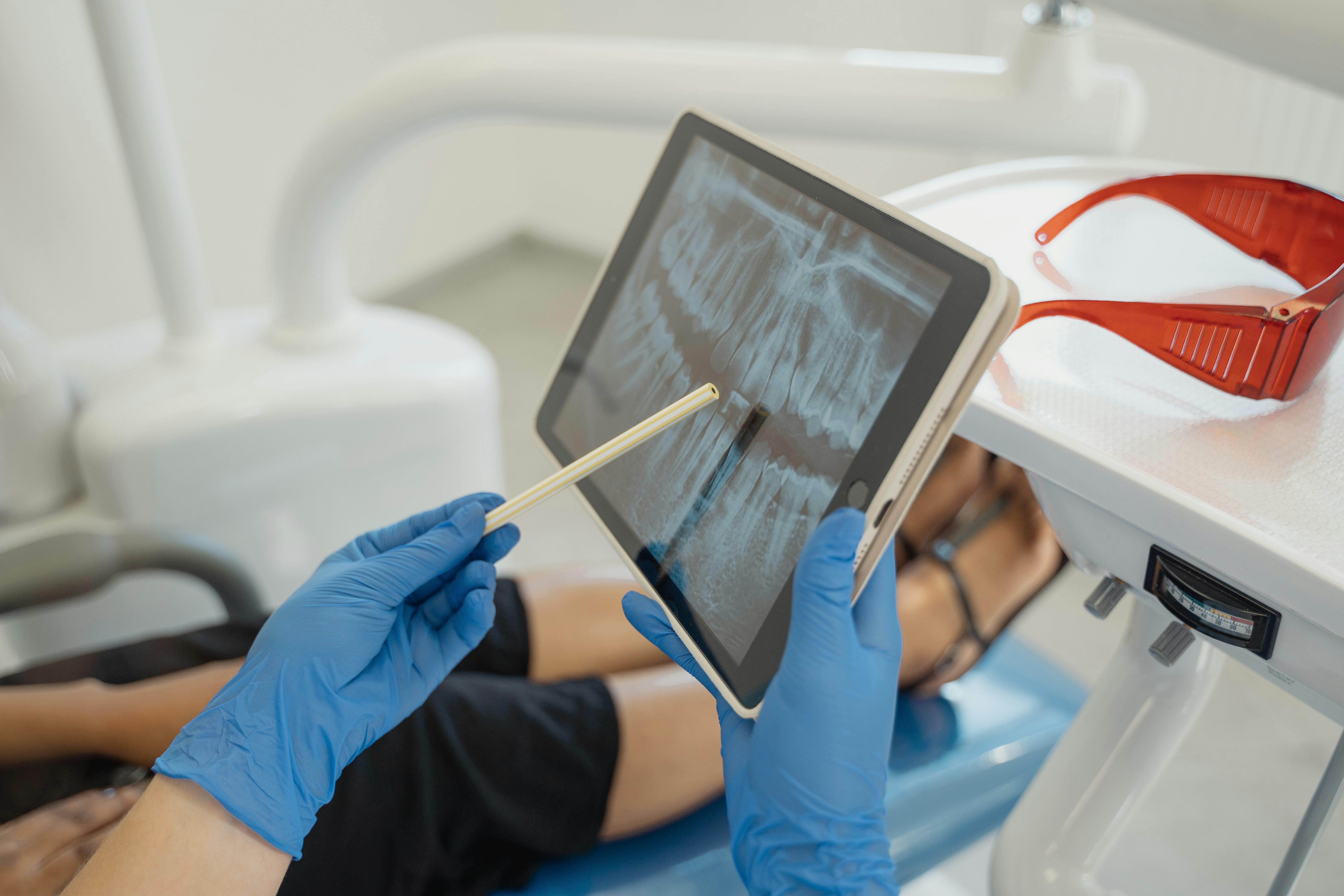 Cirugía Oral y Maxilofacial