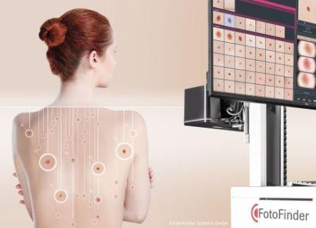 fotofinder_bodyscan_atbm__segu_16138fa9