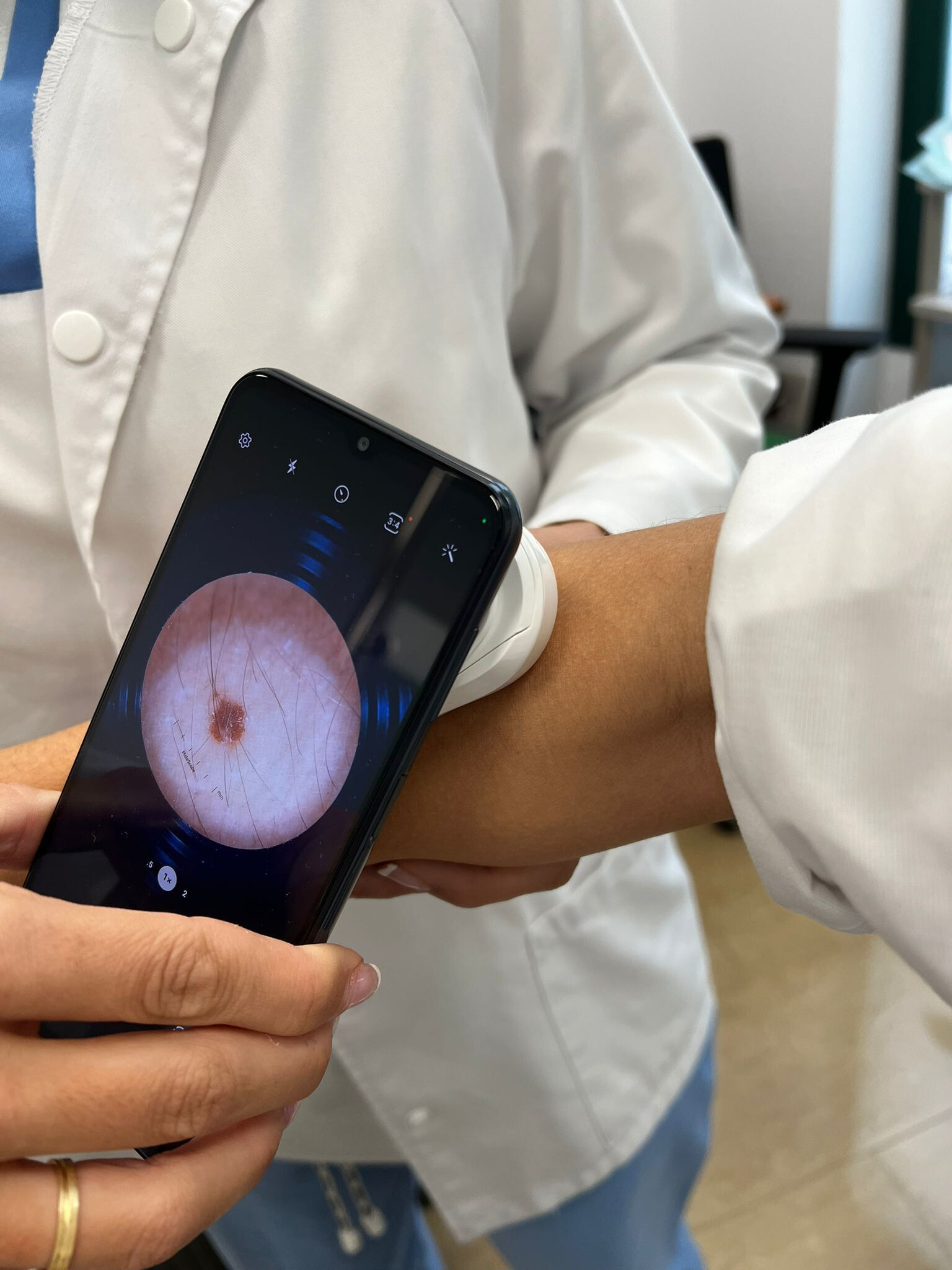 Hospiten incorpora tecnología avanzada para la detección temprana de lesiones en la piel