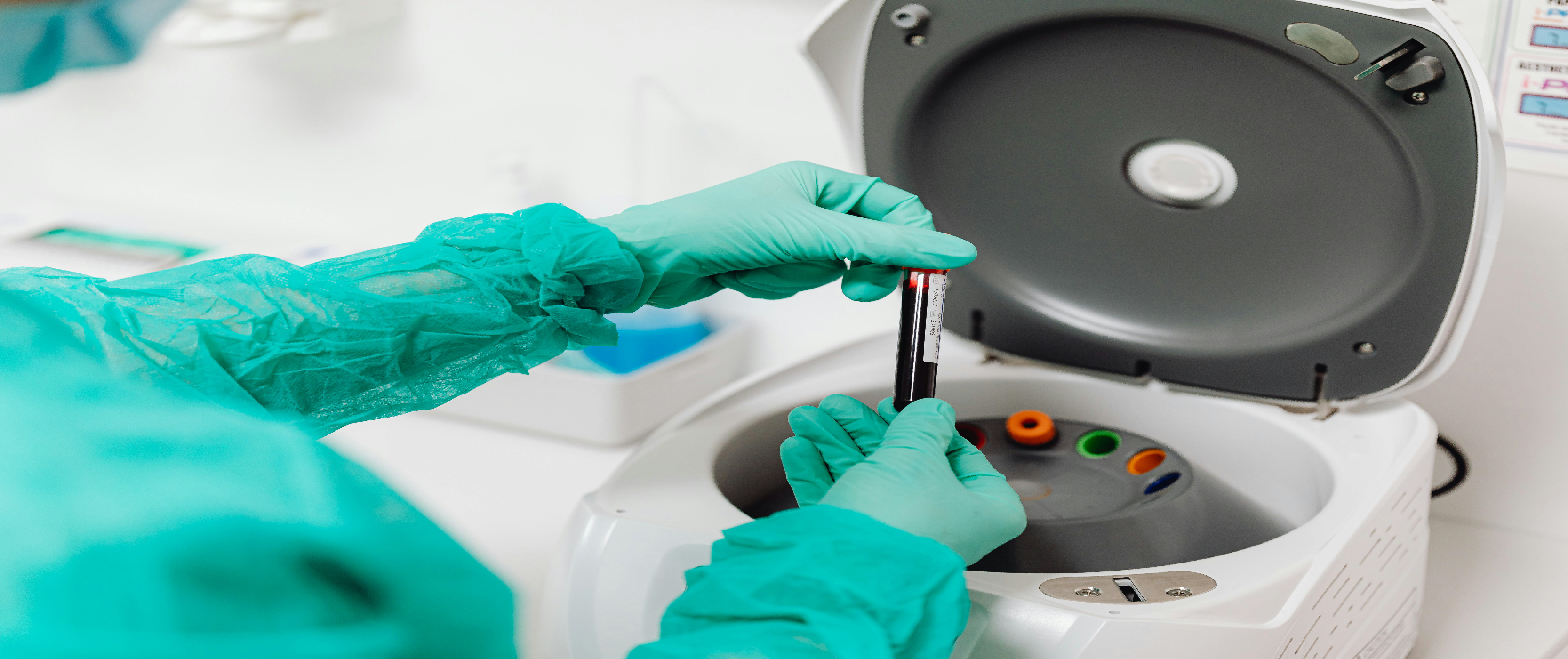 Medicina regenerativa: Plasma enriquecido en plaquetas